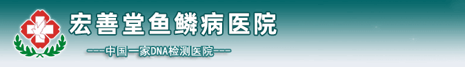 |鱼鳞病|中医鱼鳞病方法|鱼鳞病偏方|毛周角化症|遗传性鱼鳞病预防|郑州鱼鳞病|